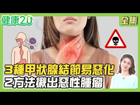 50歲女歌手脖子長3顆甲狀腺結節 3種結節易惡化！超音波、穿刺揪惡性腫瘤！手術後補充維生素D、鋅、硒平衡甲狀腺！健康2.0 20250608【完整版】#鄭凱云#鄭凱倫#沈彥君#黃淑惠#陳麗華#陸巧因