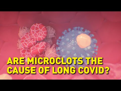 What causes long COVID?