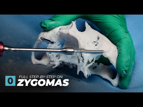 26 Minute Zygoma Class - ArchX