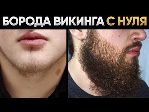 ЗАПУСТИЛ рост бороды с помощью лосьона mr.Volos/ Результаты за каждый месяц