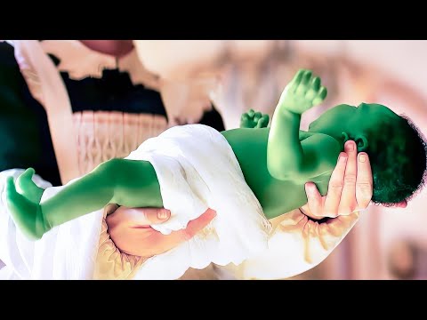 Girl Born Different Gets Bullied Until They All Regret It