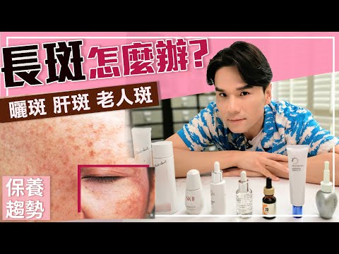超強淡斑攻略,雀斑、曬斑、孕斑、老人斑一次搞懂!ll Kevin想得美 ll How To Remove Dark Spots On Face