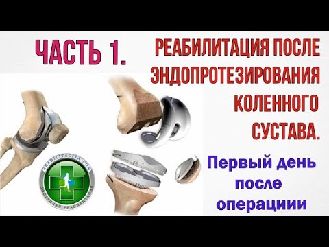 Эндопротезирование коленного сустава. Первые дни после операции.