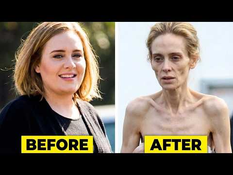 15 SHOCKING Celebrity OZEMPIC Transformations of 2025 That Went Too far