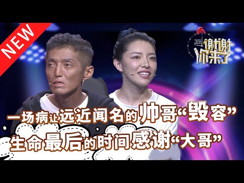 【NEW】谢谢你来了20220322：帅小伙因为一场病严重毁容，趁最后的日子感谢“大哥”！像男人一样坚强的大姐！