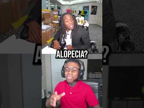 Kai Cenat Exposes Rakai's Alopecia😭