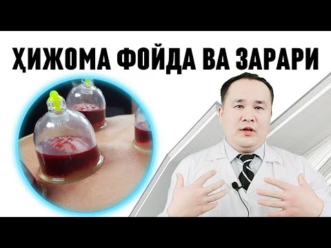 ХИДЖОМА ХАҚИДА ХАҚИҚАТЛАР ВА БОР ГАПНИ АЙТИБ БЕРАМАН