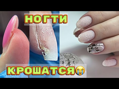 Nails crumble 😬 Nail hypersensitivity 💅 Manicure hack