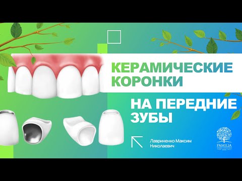 😁 Керамические коронки на передние зубы