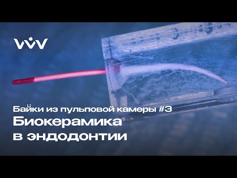 Биокерамика в эндодонтии | Спасаем корневые каналы