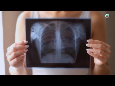 TVB最強生命線|早期肺癌篩查 (繁 / 簡字幕)|醫療|治療|中醫|無綫新聞|TVB News