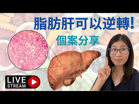 脂肪肝如何消除 ? 非酒精性脂肪肝個案分享 | 逆轉脂肪肝飲食方法 ! 脂肪肝吃甚麼好? 營養師媽媽Priscilla(粵語中文字幕) (按cc打開/關掉字幕)