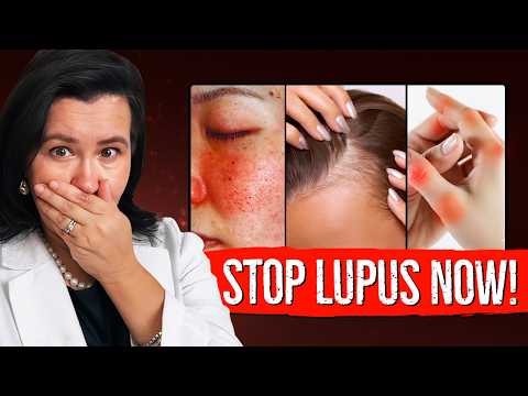 LUPUS Exposed in 10 Minutes