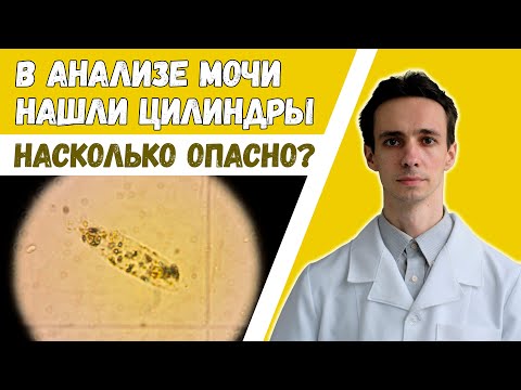 Цилиндры обнаружены в анализе мочи? Стоит ли бить тревогу? 2023