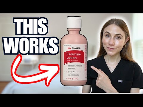 Calamine Lotion Hacks Nobody Told You About