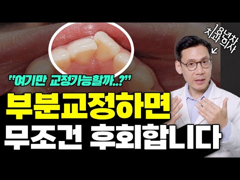 '이런경우' 아니면 부분교정 하지마세요. 부분교정 진단기준 총정리