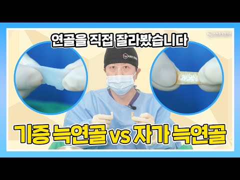 기증 늑연골 vs 자가 늑연골, 실제 차이 보여드립니다!🦴 직접 커팅까지 | 비트윈성형외과