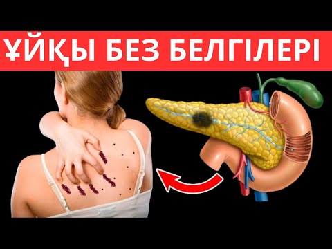 Ұйқы безі ауруының алғашқы 5 белгісі. Ұйқы безін қалай емдеуге болады