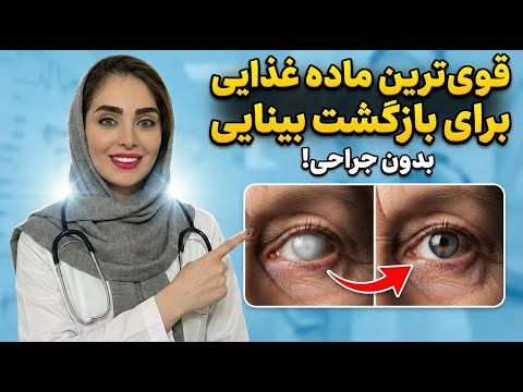 راز شوکه‌کننده چشم‌پزشک‌ها! این غذای ارزان بینایی رو ۱۰ از ۱۰ می‌کنه