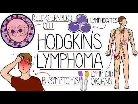 Hodgkin's Lymphoma Explained (With Classification)