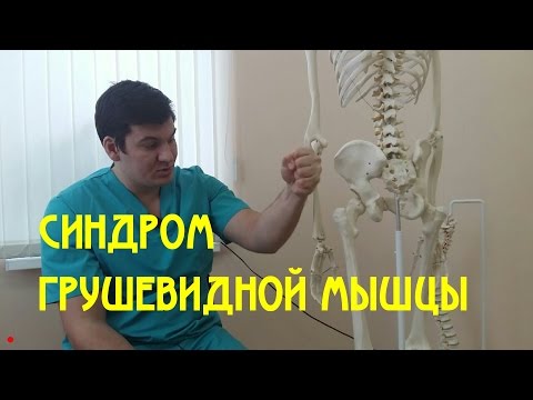 Синдром грушевидной мышцы Piriformis syndrome