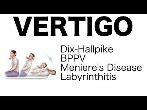 Vertigo (Different Types, Dix-Hallpike Maneuver, Treatment)