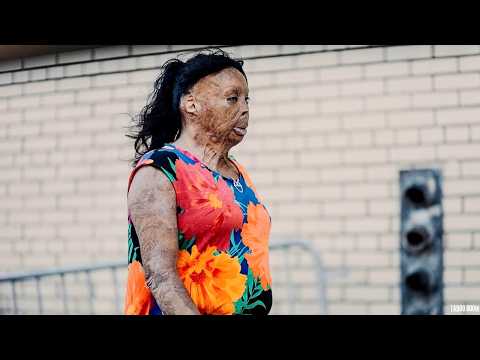 The Flesh-Eating Drug Taking Over Canada, Vancouver  | Documentary