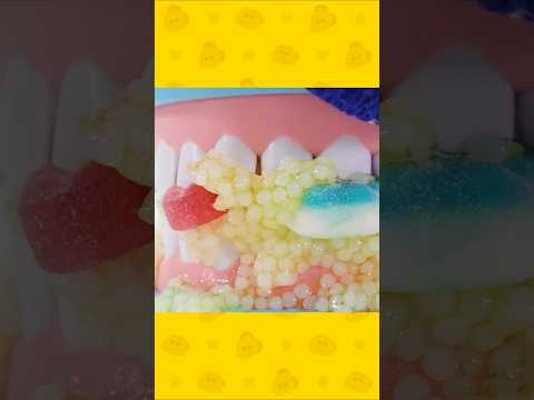 으악! 이빨에 젤리가 쩍! 안 빠져요 😱 #shorts