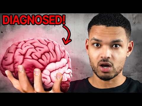 My Brain Scan Revealed ADHD!? Here's the TRUTH!