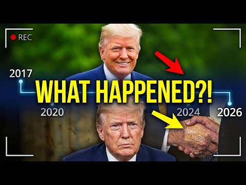 What's Wrong With Trump's Hand? Doctor Reveals SHOCKING Truth About President's Health