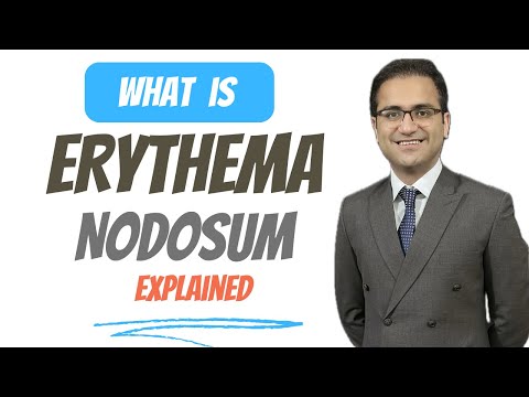 Erythema nodosum Treatment, Causes, Pathophysiology, Dermatology Lectures USMLE NEETPG