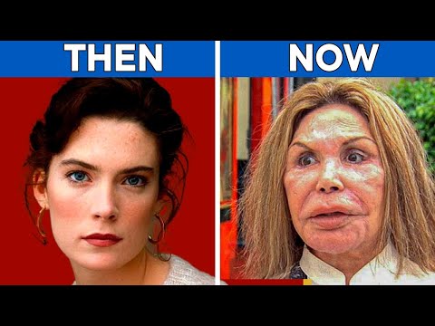 15 Shocking Celebrity Plastic Surgery Disasters 😱 | Then vs Now 2025