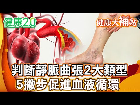 久站、久坐容易靜脈曲張 醫師教判斷靜脈曲張2大類型！2招下肢運動  超簡單隨時可以做！3秘訣助靜脈回流！【#健康大補帖】健康2.0 #鄭凱云 #陳欣湄  #韋汝