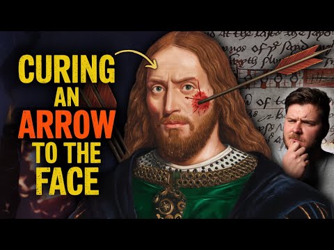 The Genius Medieval Surgery That Saved A King