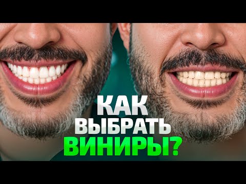 Как на самом деле делаются виниры в 2026? Весь процесс от А до Я