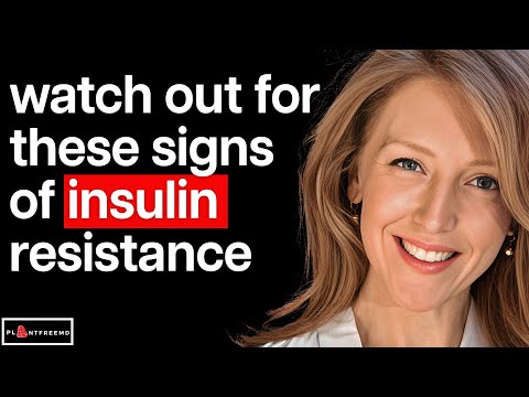 🔴 Dr. Casey Means Reveals The Science of Eating for Health, Fat Loss, & Longevity
