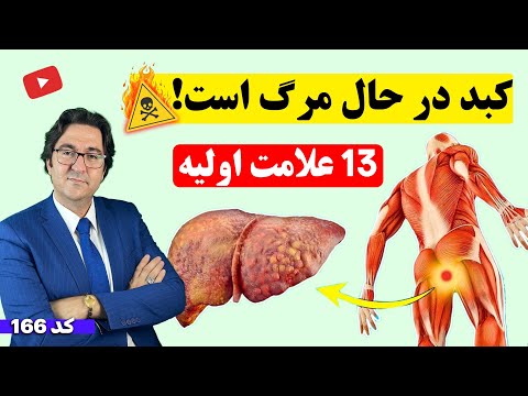13 نشانه عجیب آسیب های کبدی! | زودتر آگاه شوید و کبد خود را درمان کنید!