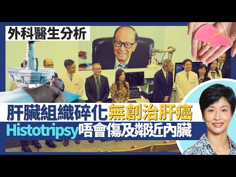 肝癌治療（下）｜李嘉誠基金會肝臟組織碎化系統無創治癌症 配合AI將腫瘤碎成液體！Histotripsy不傷內臟或血管！射頻消融術／微波消融術可致肝衰竭？｜王建芳醫生 外科醫生陳詩正醫生｜人類健康研究所