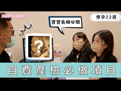 恭禧長相曝光！｜自費產檢必做項目｜羊膜穿刺的替代選擇｜產檢記錄｜兔女狼