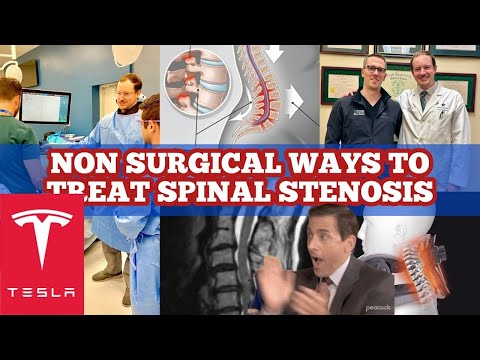 NON-Surgical Ways to Treat Spinal Stenosis