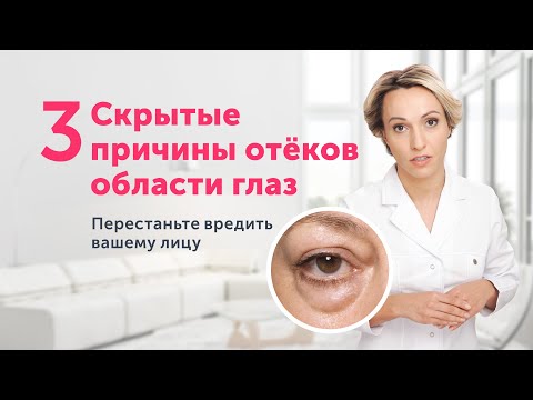 Eye puffiness and bags: little-known causes and one useful exercise