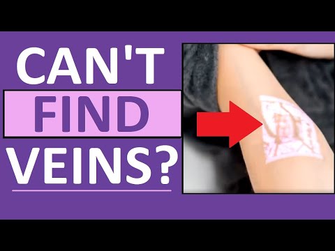 Hard to Find Veins Blood Draw, IVs, Venipuncture - Nursing, Phlebotomy