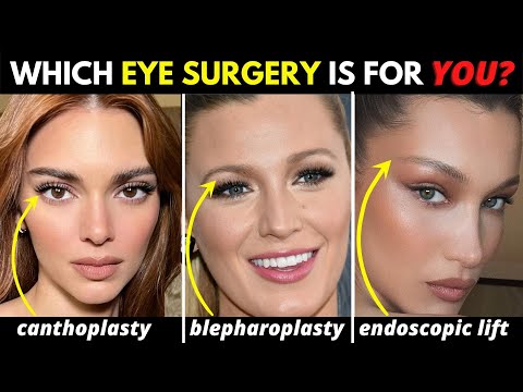 Blepharoplasties 101: Which eye surgery will make YOU look younger?