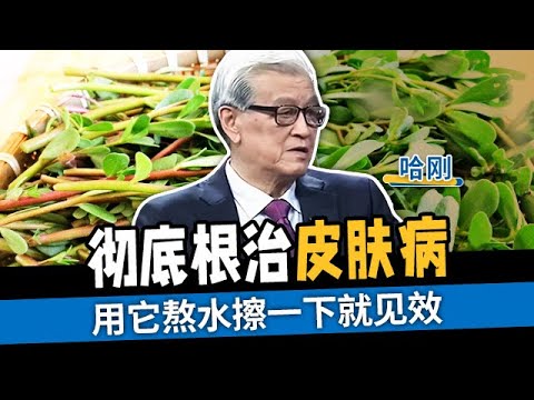 和皮癣、湿疹、瘙痒说再见 用它熬水擦一下 彻底根治皮肤病【国医养生】
