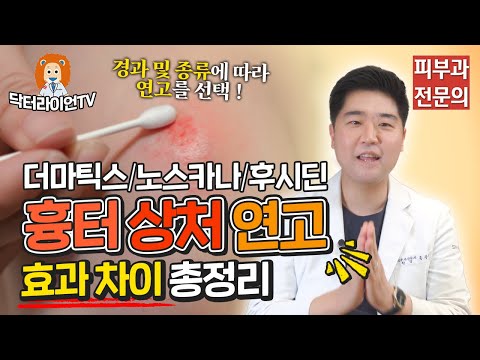 상처/흉터 연고❗ 잘못 사용하면 큰일납니다💥 (더마틱스/노스카나/후시딘 차이점 총정리)