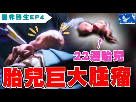 胎兒長出巨大腫瘤 腫瘤比頭還大! | 良醫墨非/天才肖恩S1EP4 | 蒼藍鴿評評理EP74