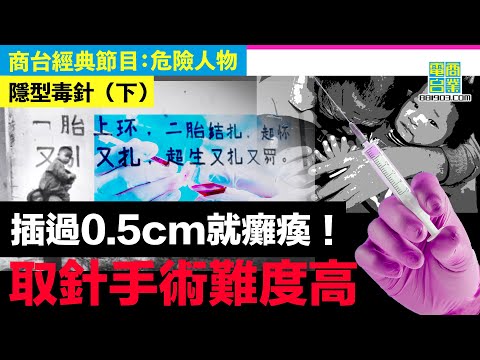 【犯罪檔案室‧隱型毒針(下)】嫲嫲重男輕女 直認孫女一歲時偷偷插五針入頭、肺、肝/ 鋼針入肉女孩大難不死 取針手術難度高要開頭剖胸