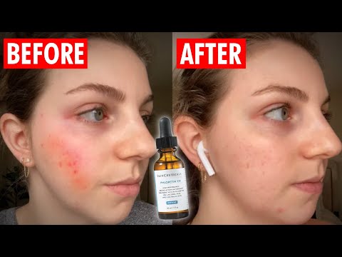 Top Anti-Aging Serums That Actually Work (Derm-Backed Picks for Every Budget) ✨