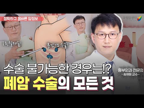 흉강경? 구획절제? 기본부터 심화 내용까지! 폐암 수술의 모든 것 I 국립암센터 폐암센터 흉부외과 송재원