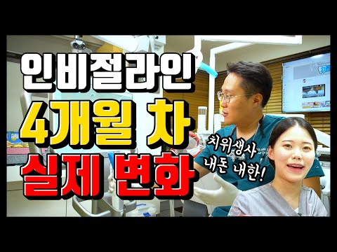 인비절라인 4개월 차! 변화된 실제 치아 모습 공개! (feat. 치위생사 내돈내한)